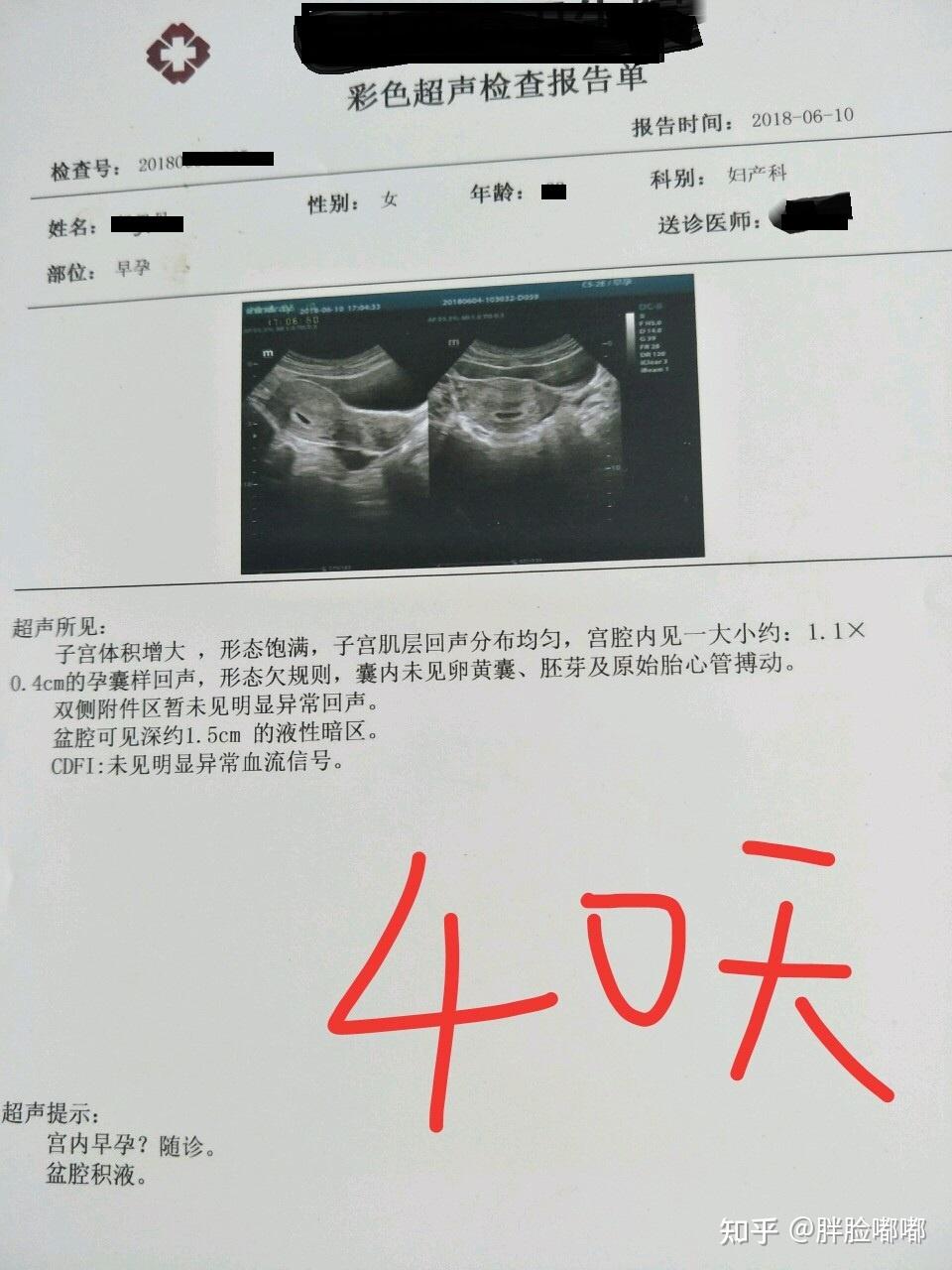 怀孕多久需要检查孕囊大小