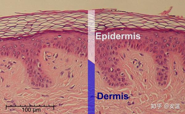 真皮层是结缔组织,主要有纤维,基质和细胞构成,此外还有血管,神经