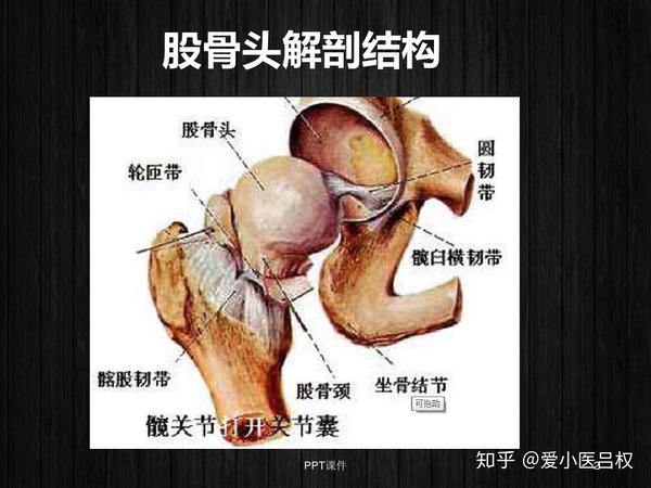 股骨头坏死患者逐渐或突然经历间歇性或连续性髋部疼痛