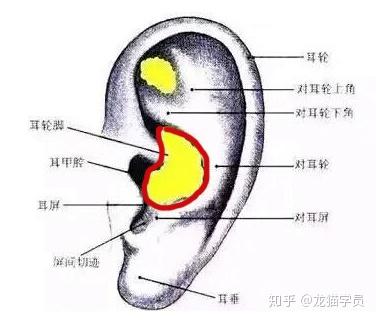 如果方法正确合理,耳朵是不会变形的,因为取耳软骨的耳窝部位不是耳朵