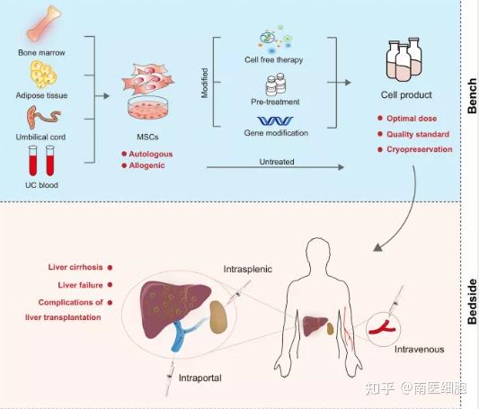 干细胞治疗显著改善了失代偿性肝硬化的肝功能及长期生存率