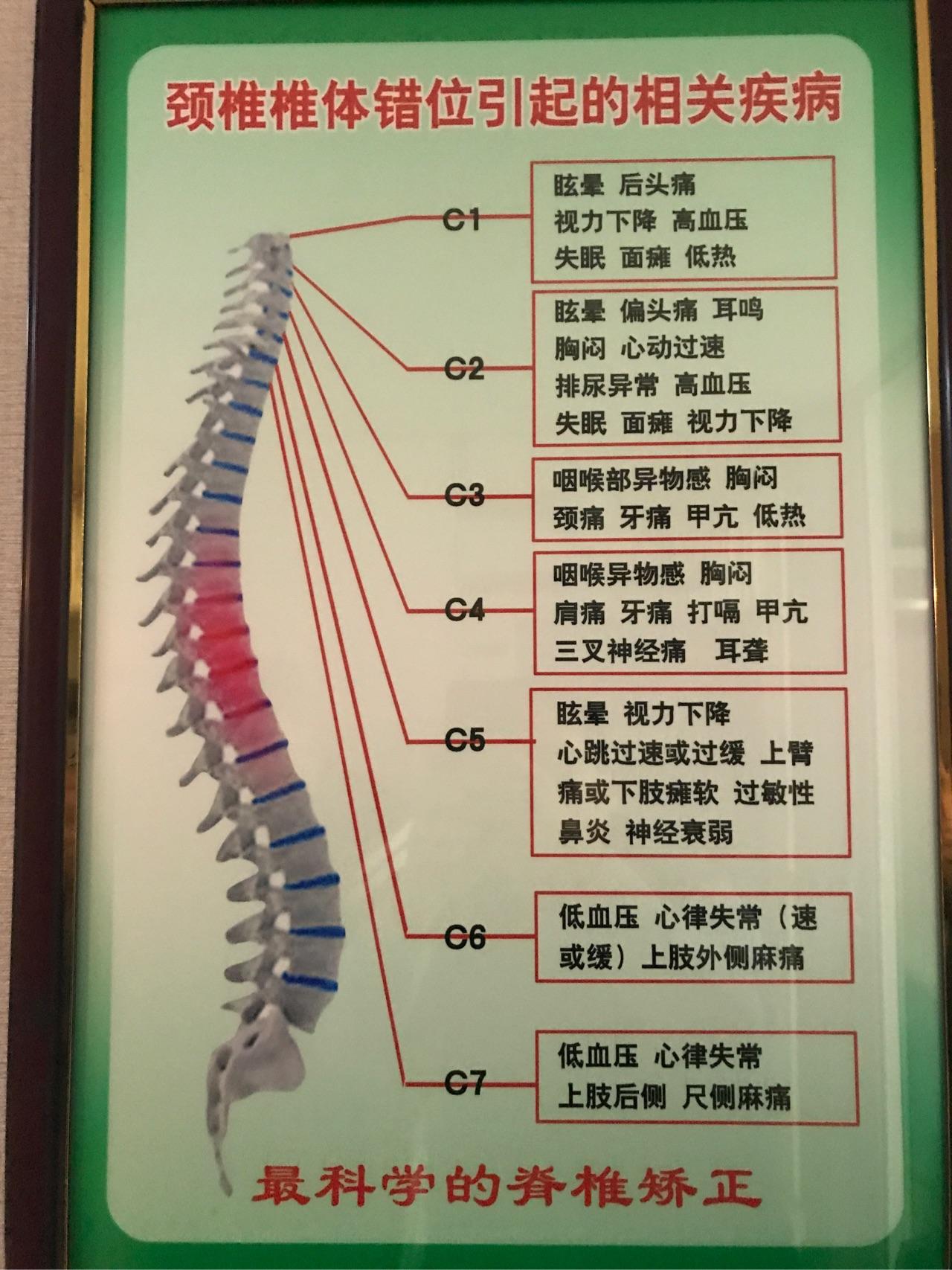 谢邀,你这个属于长时间久坐低头引起的颈椎问题,经后侧肌肉僵硬,还有