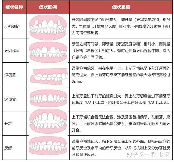 根据世卫组织的资料,错颌畸形指牙列不齐,包括牙列拥挤,空隙牙列,前