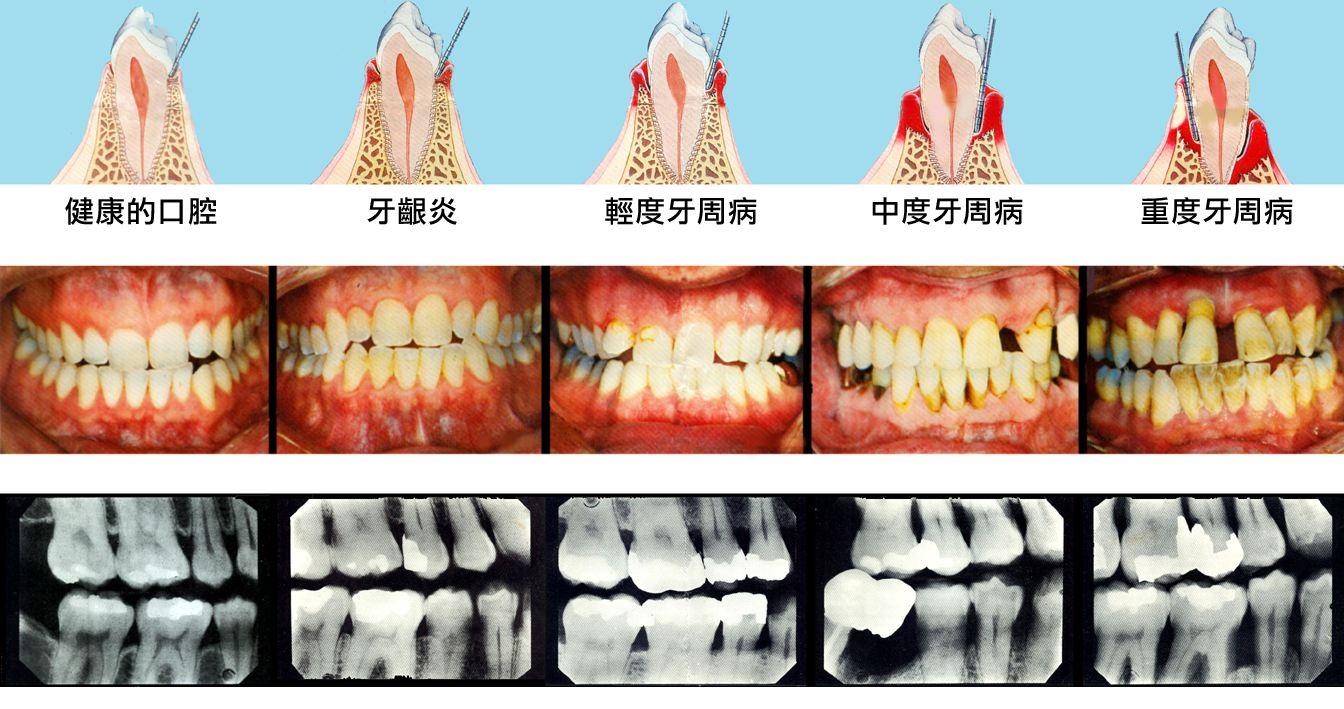 中国居民口腔健康指南1普通人群篇