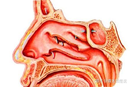 首大陈潜:鼻腔囊肿都有哪些危害