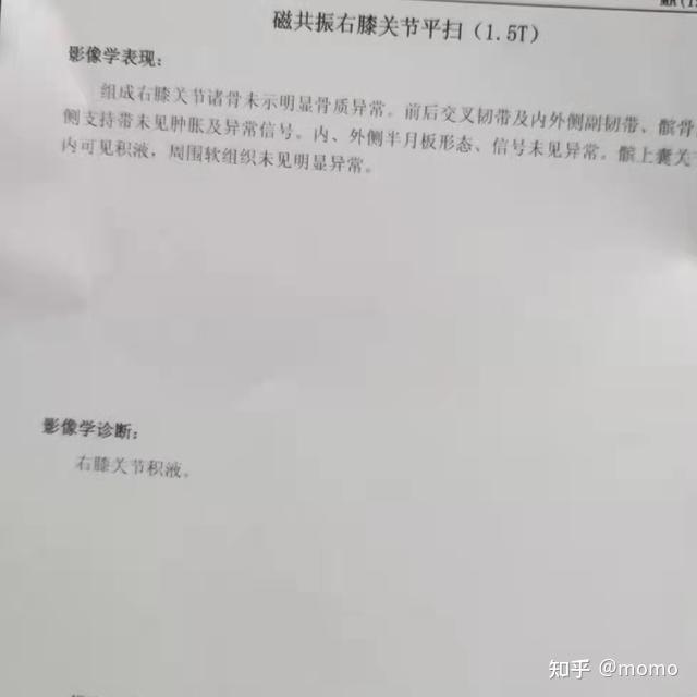 医生让拍片子,结果出来医生说是关节滑膜组织损伤引起是滑膜炎症