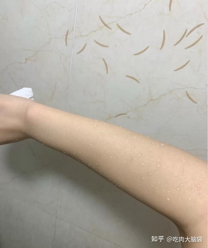 脱毛膏用久了会得皮肤癌吗?
