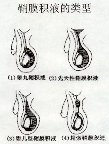 蛋蛋突然增大要小心