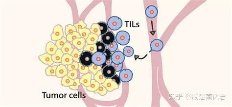 til(肿瘤浸润淋巴细胞)模式图图片来源:lab-porter.com