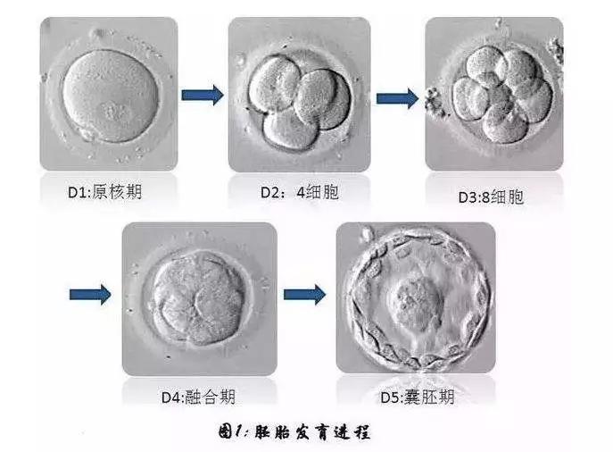 哪些人最适合囊胚培养和移植?