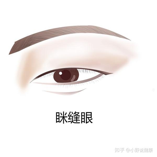如何判断自己是哪种类型的眼睛