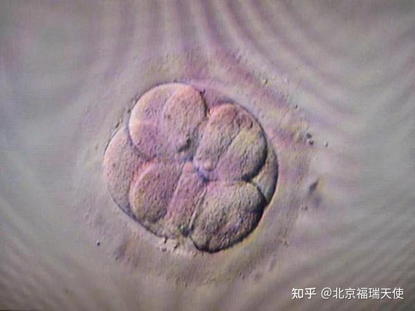 试管婴儿移植囊胚是不是比移植第3天胚胎妊娠率高呢?——北京福瑞天使