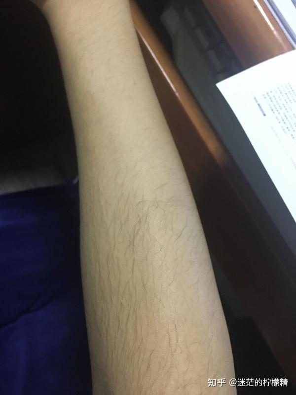 作为一个女的,我全身长毛,胳膊腿上的毛比我男朋友长. 变化和收获.