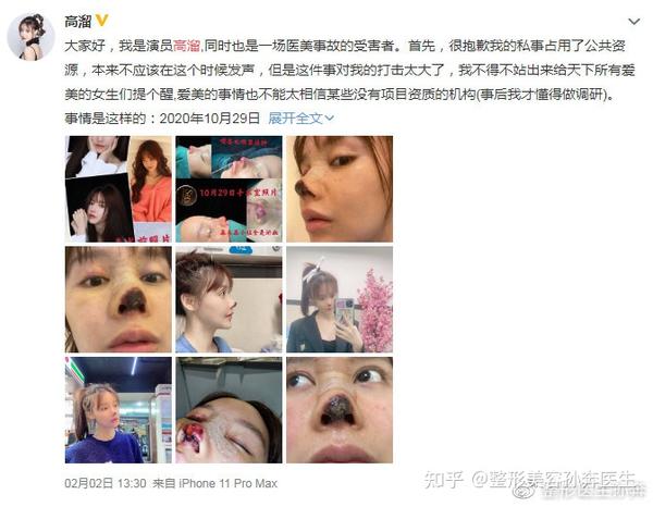 隆鼻后会出现鼻头坏死是什么原因造成的?