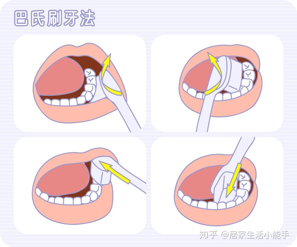 圆弧刷牙法的要领就是"画圈圈",尤其是牙齿外侧比较容易操作,里侧和