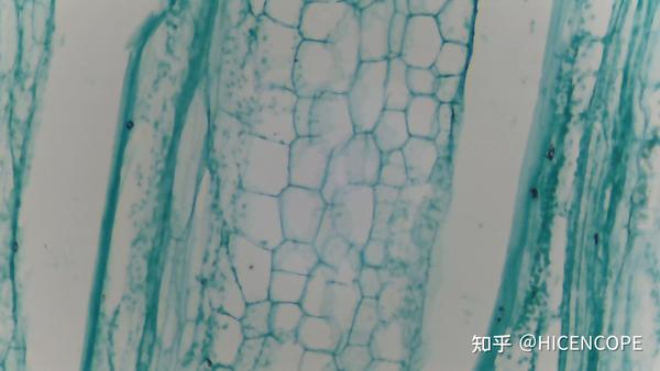 蒲公英绒毛 绒毛称之为冠毛,白色冠毛形成毛茸茸的小伞,头状花序直径