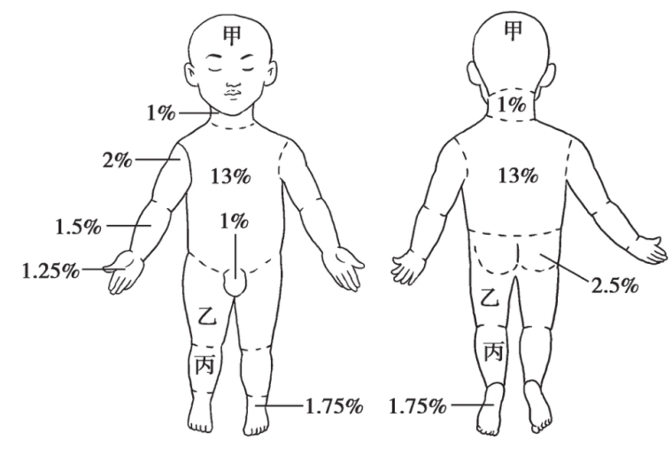 如下图,为小儿烧伤体表面积计算图(不分年龄:小面积烧伤,可以用手掌