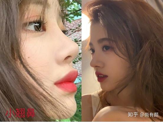 艺术鼻:给人感觉很温柔,鼻子正面端正,侧颜弧度流畅,艺术气息十足,骨