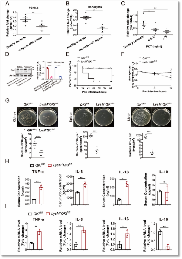 Cell Biosci Rna Qki Mrsa