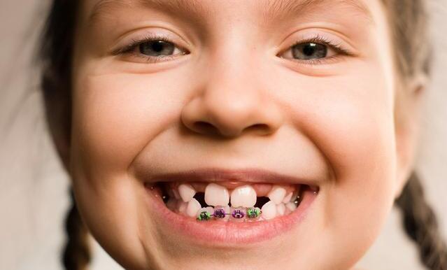 儿童牙齿矫正四大误区家长要当心