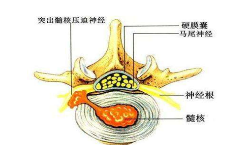 马尾神经损伤有什么用?