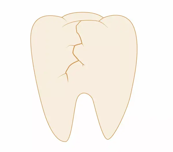 牙齿上有裂纹是怎么回事