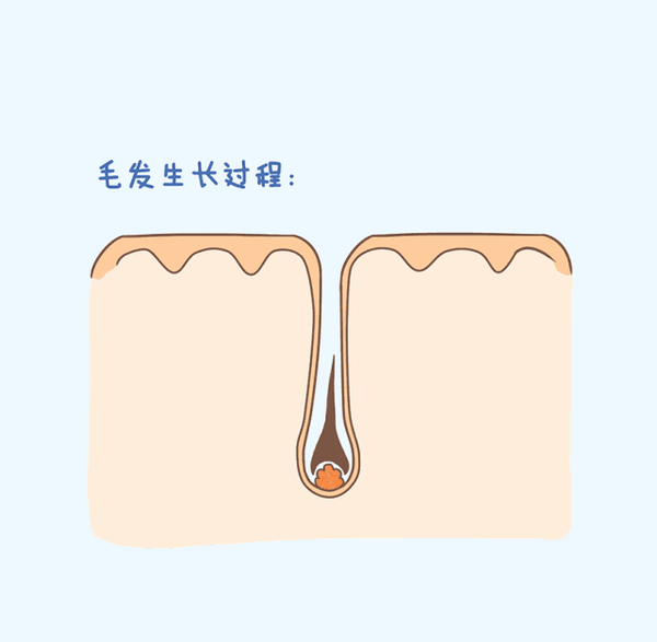 当毛囊受到破坏,生长速度跟不上脱发速度,就会造成我们发量少甚至颓头