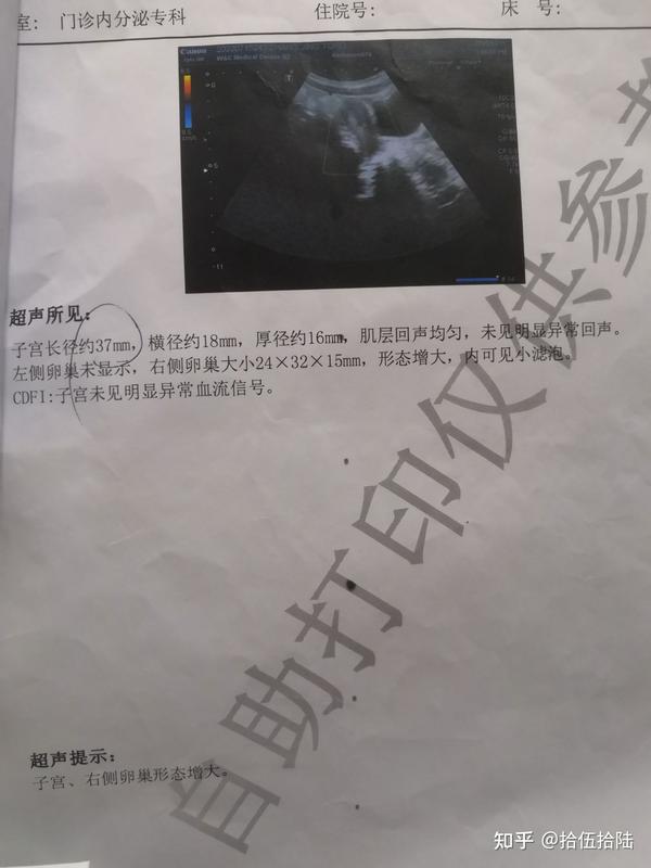 骨龄偏大2岁,记录治疗青春期发育过早/青春期加速