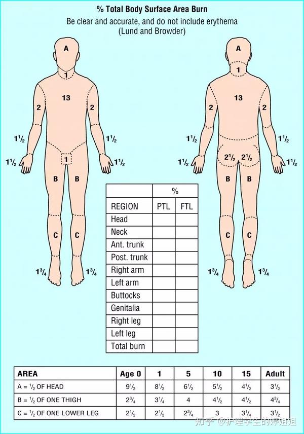 百分之百正确的小技巧快速分辨烧伤分度妙算烧伤面积