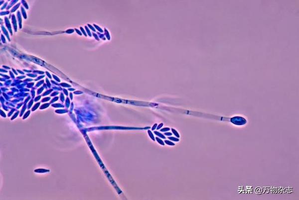污染谷物的常见真菌镰孢菌 图片来源:wikipedia