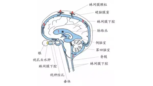 脑脊液耳漏:颅中窝骨折累及鼓室所致 注意: 耳漏和鼻漏主要