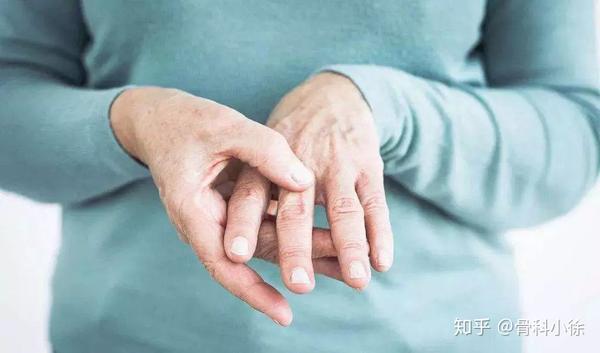 风湿性关节炎vs类风湿性关节炎,到底有哪些不同?