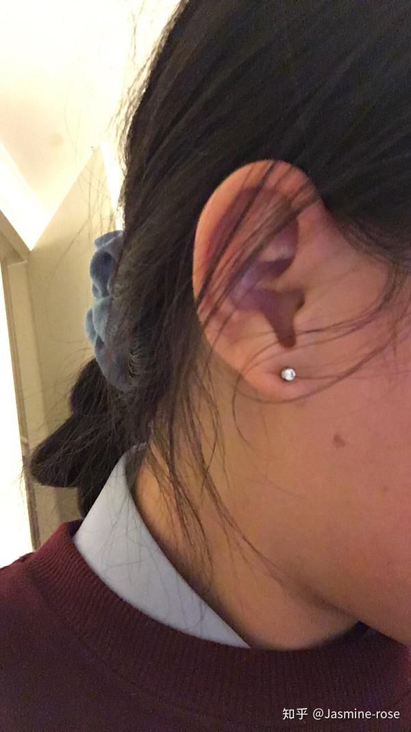 打耳洞是用原医用钢钉好还是自己换纯银耳棒好?