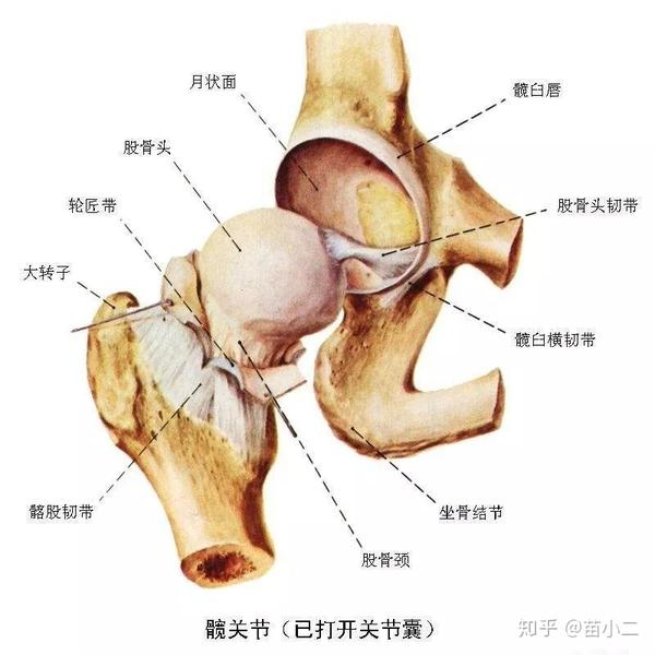 髋关节综合症应该怎么治疗