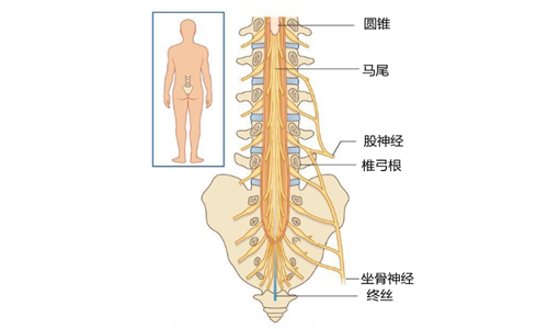 马尾综合征和脊髓圆锥有关系吗有什么相似的地方吗