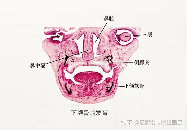 胚胎第9周起,上颌突的下缘