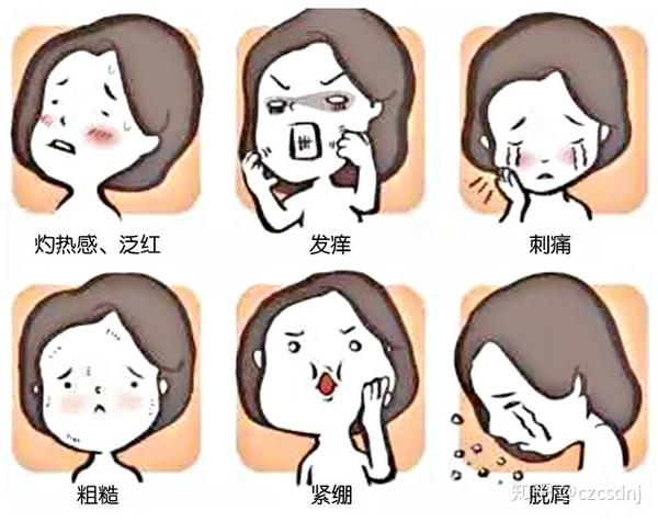 激素依赖性皮炎治疗方法?激素脸裸脸真的好吗