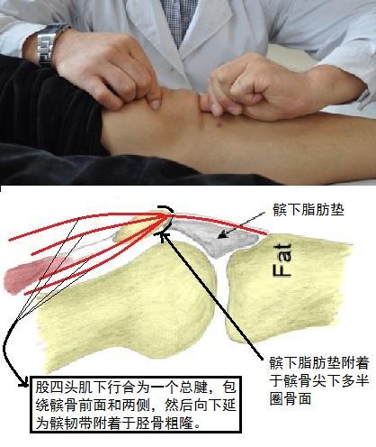 大拇指朝上压揉髌骨尖下面,这里是髌下脂肪垫附着位置