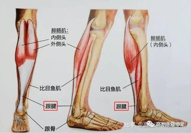 跟腱断裂修复术后康复案例