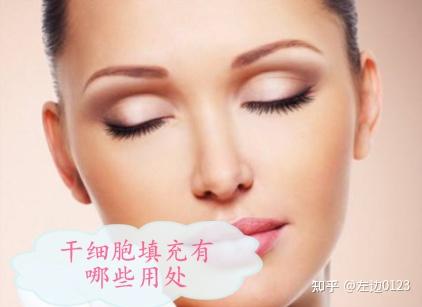 干细胞填充面部好不好?干细胞美容可以管多久?看完就知道了