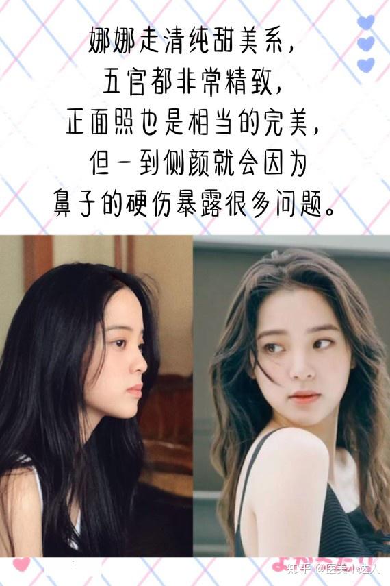 欧阳娜娜微调鼻子了吗? - 知乎