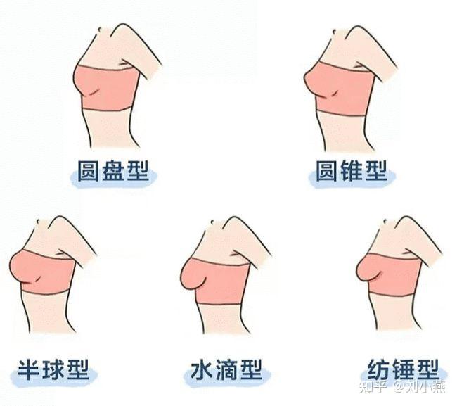 还有 水滴型和纺锥型的仙女,可千万别觉得自己是下垂,这只是胸部脂肪