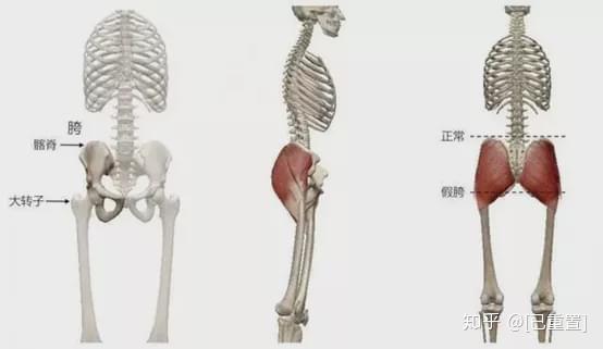聊聊唐艺昕被吐槽的胯骨变形.