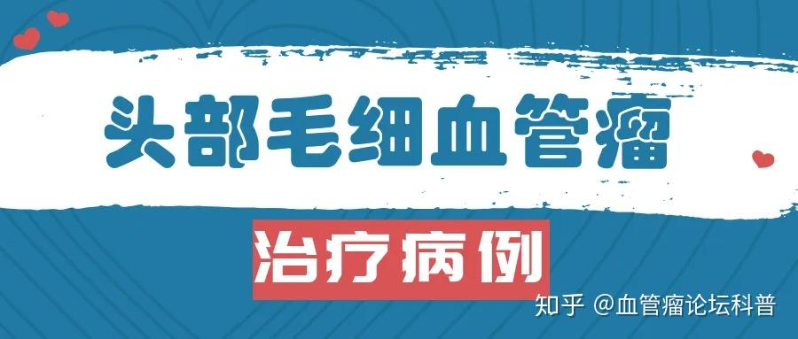 头部毛细血管瘤治疗后会影响头发生长吗