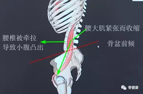 劳损的腰大肌出笼的百病之源