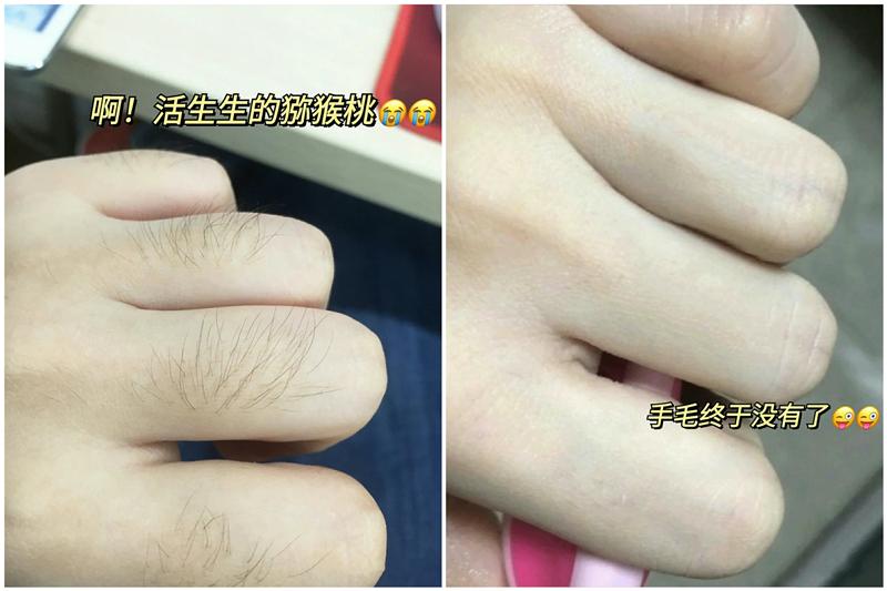2021年脱毛仪有用吗亲身实测真的不是智商税8款超实用推荐