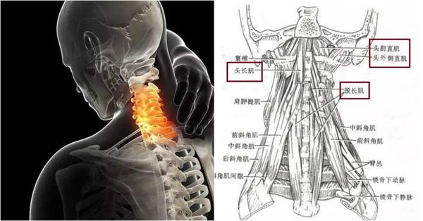 分为颈长肌,头长肌,头前直肌,头外侧直肌, 附为颈椎椎体胸椎椎体.