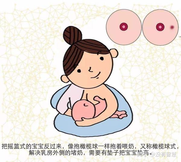 堵奶如何处理