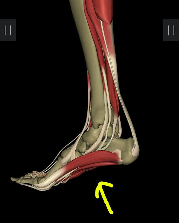 一年前打球脚崴过一段时间后感觉右脚脚底有根茎绷着,用指关节顶,感觉