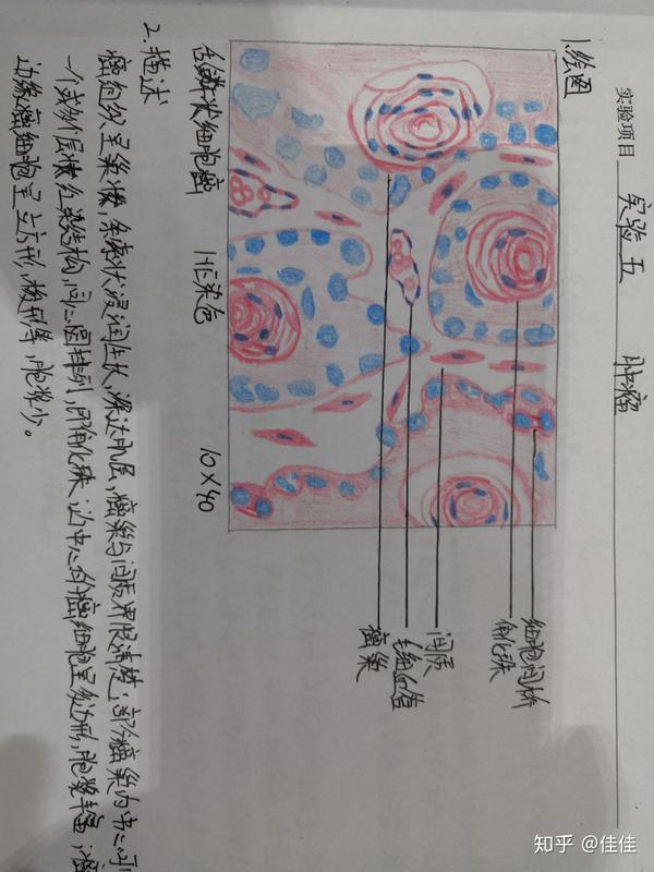 医学生 病理学 实验报告 (红蓝铅笔绘图)